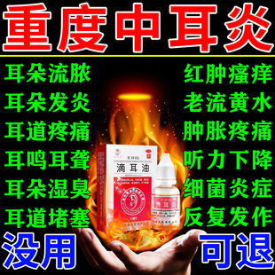 滴耳液中耳炎专用药可除耳根滴耳油治耳道发炎流脓耳朵痒流黄水