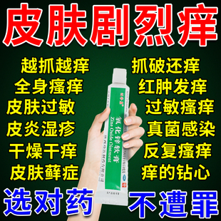 氧化锌软膏正品湿疹止痒根去外用顽固皮炎皮肤瘙痒止痒特新效药膏
