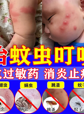 [舒笑]丹皮酚软膏10g*1支/盒