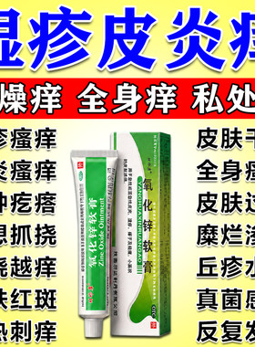 氧化锌油软膏止痒特药效皮肤瘙痒湿疹外用顽固皮炎第名一