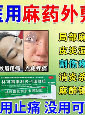 利多卡因麻药乳膏麻药外敷脸部医用麻药膏点痣点疣纹身纹眉局麻药