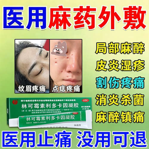 利多卡因麻药乳膏麻药外敷脸部医用麻药膏点痣点疣纹身纹眉局麻药