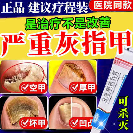 治疗灰指甲专用药水正品旗舰店亮甲灰趾指甲膏非特效第一1名液药