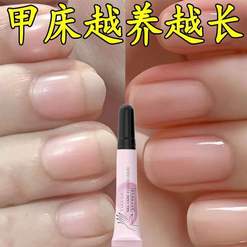 【养出自然真指甲】指甲营养液油增长液修护甲床增厚竖纹防断空甲