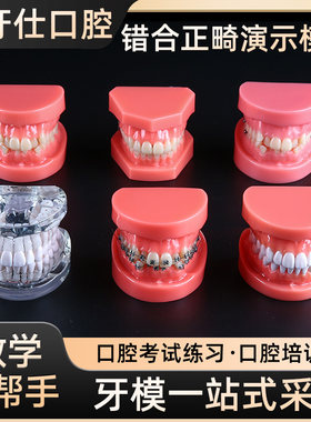 正畸模型医患沟通教学模型