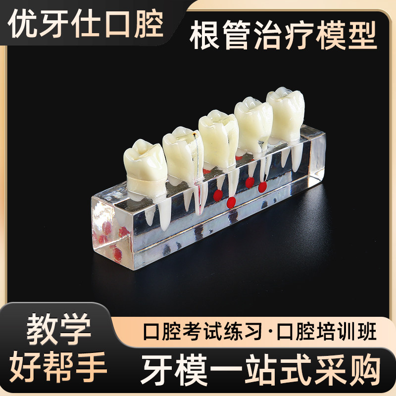 牙科口腔根管治疗模型前磨牙牙髓修复可拆修龋齿医患沟通病理演示