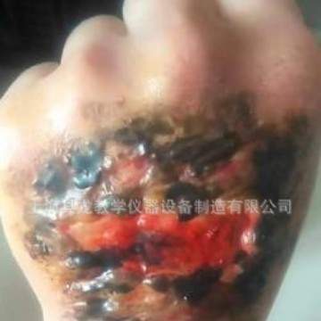 人员中毒仿真模型 教学对比训练模型 卫勤模拟训练模型  人员仿真