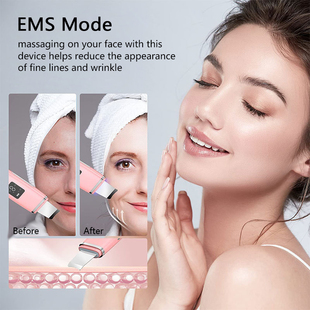 Scrubber 速發Peeling Ultrassonico Skin Blackhead Exfoliating