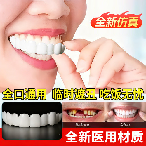吃饭遮丑专用牙套全口通用