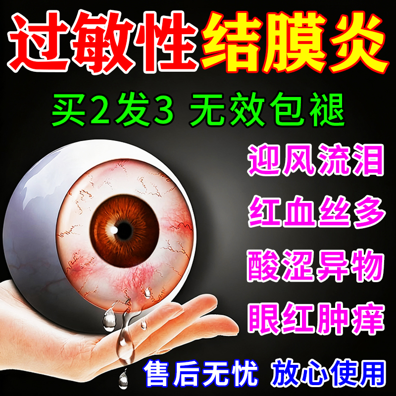 过敏性结膜炎眼贴干眼症冷敷改善眼睛痒干涩疲劳模糊红血丝专用