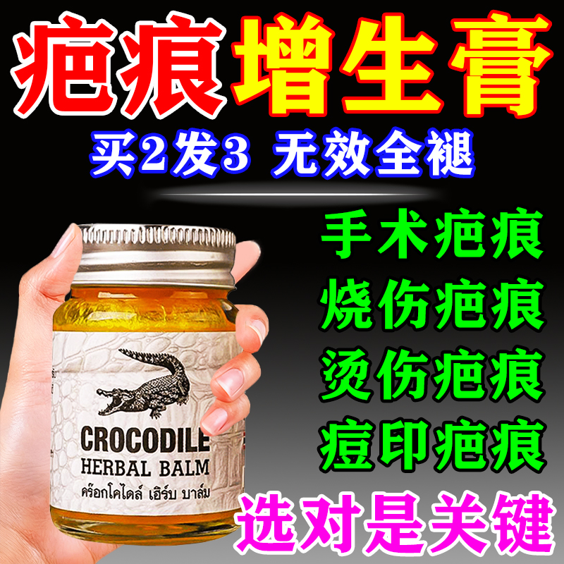 鳄鱼祛疤膏泰国进口手术缝针烧烫伤增生点痣痘印剖腹产疤痕修复膏