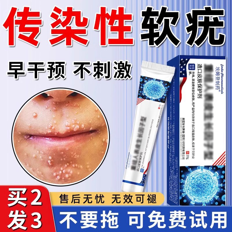 传染性软疣儿童脖子上长小肉粒疙瘩丝状非去除病毒性水瘊子非药膏