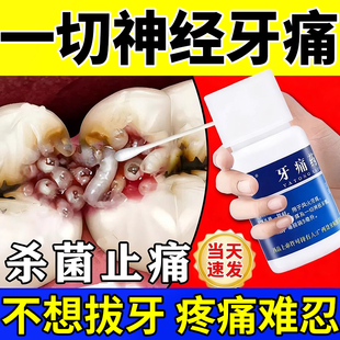 儿童牙疼牙痛止疼药速特货效消炎止痛专用牙龈肿痛药【视觉特效】