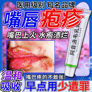 嘴唇疱疹特疗效药口角炎嘴巴上火起水泡烂嘴角专用药膏水嘴巴溃疡