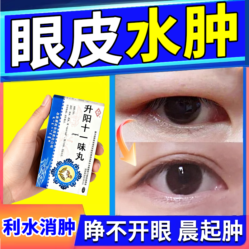 上眼皮水肿消肿专用药去浮肿肾阳虚肿眼泡消肿神老器人眼睛睁不开