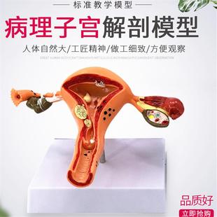女性生殖解剖模型 女性大子宮模型放大模型 計(jì)劃生育示教模型