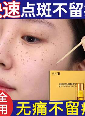 祛斑点斑专用药水精华液分解黑色素雀斑老年斑不留疤正品强力去除