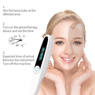 311NM UVB Narrow Band UV Light Source Treatment Vitiligo Ps