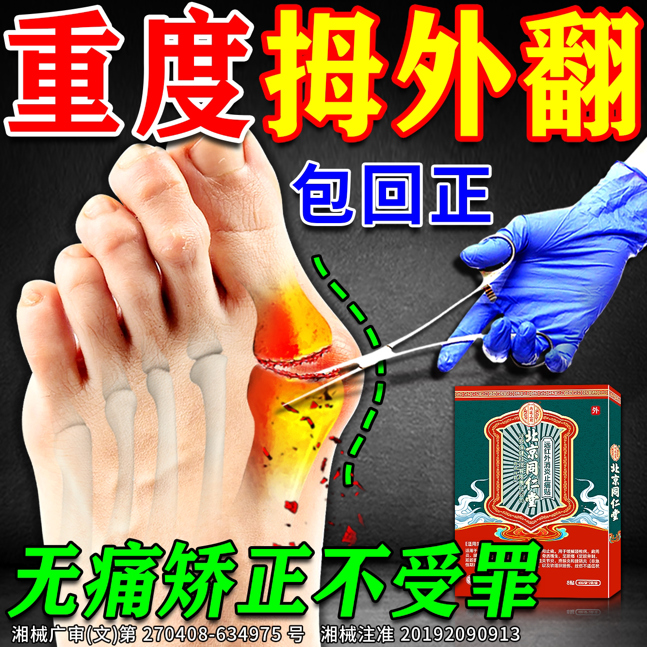 拇指外翻药膏贴大拇脚趾骨疼痛关节畸形拇囊炎大脚趾骨变形矫正器