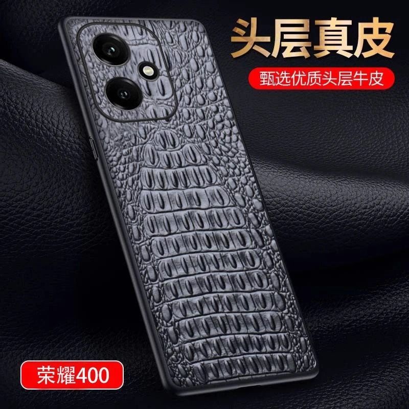 华为荣耀300ultra手机壳Honor400pro保护套头层牛皮p200por高端商务鳄鱼纹真皮套H0n0r100pr0镜头全包后壳男