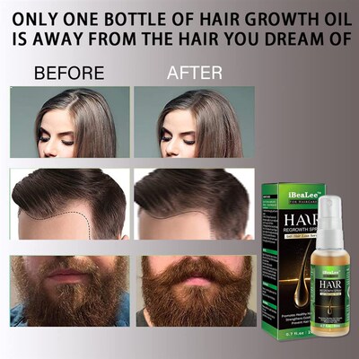 极速Gingedr Hair Growth Essential Oil Natural Anti Hairs Los