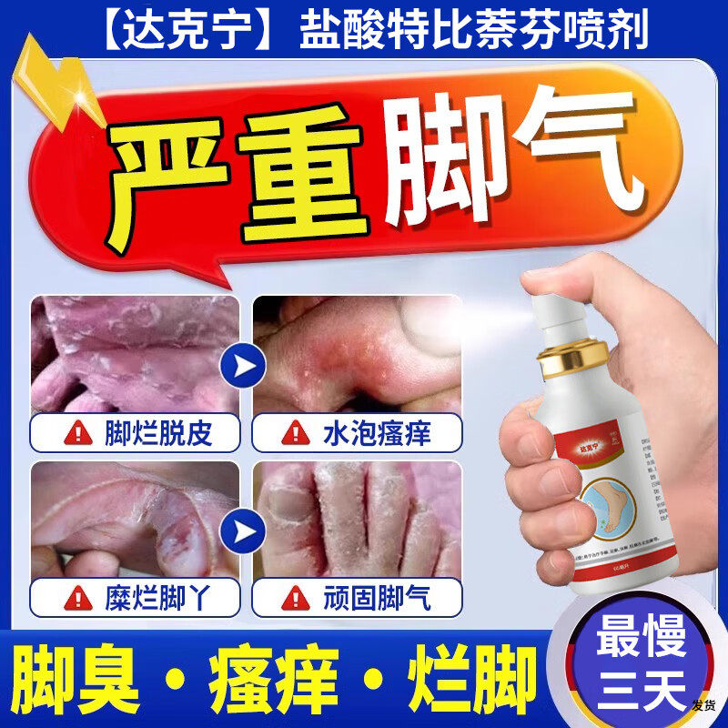 【达克宁】盐酸特比萘芬喷雾剂1%*60ml*1瓶/盒