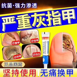 环吡酮胺擦剂灰指甲专用药环吡酮搽剂官方正品旗舰店环丙酮擦搽剂