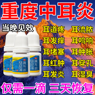 氧氟沙星滴耳液中耳炎专用药不可除根滴耳液治重度耳鸣的药第一名