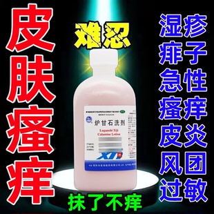 炉甘石洗剂治皮肤瘙痒皮炎湿疹荨麻疹过敏止痒成人儿童可用药水S