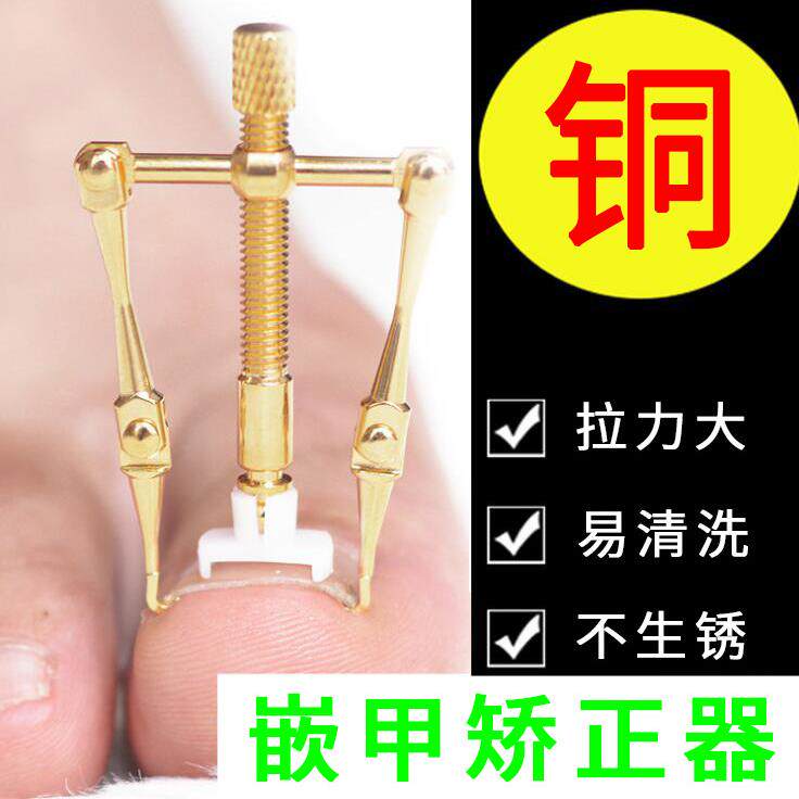 现货 铜嵌甲矫正器 卷甲 肉包甲 纠正器 正甲贴 正甲丝