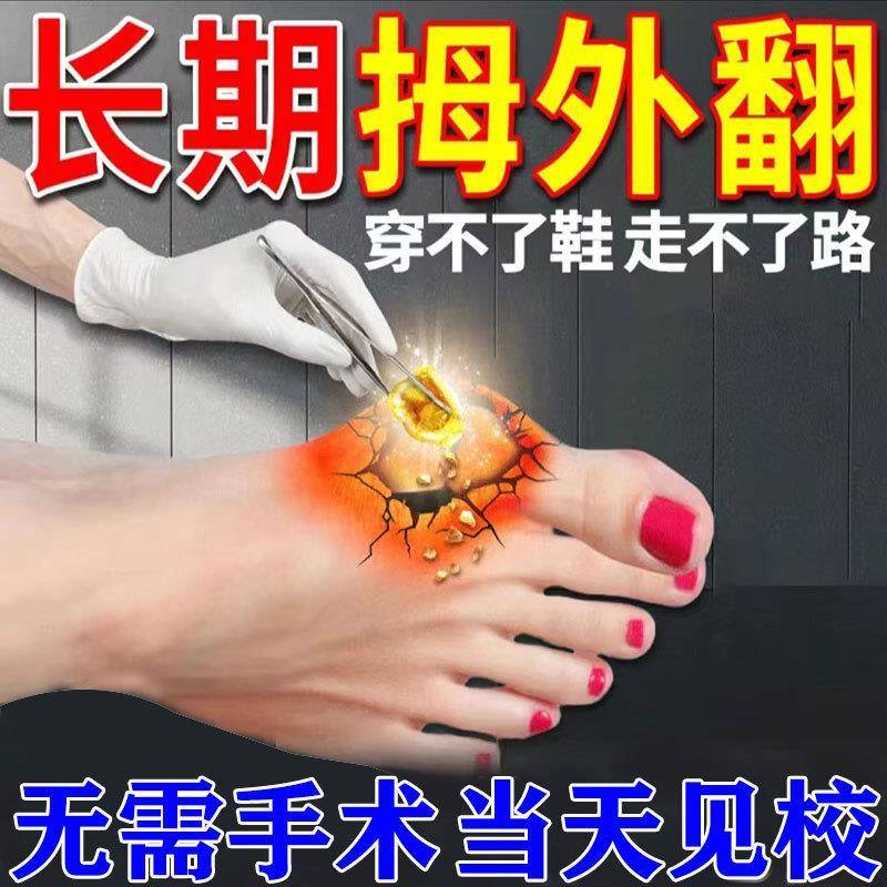 拇指外翻贴大脚骨大母脚趾外翻矫正器纠正脚趾重叠防磨外翻专用贴