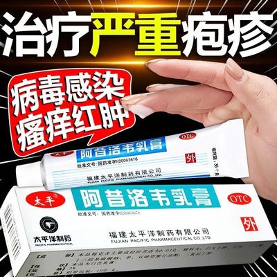 阿昔洛韦软膏乳膏正品官方旗舰店非进口凝胶乳膏抗病毒皮肤疱疹GY
