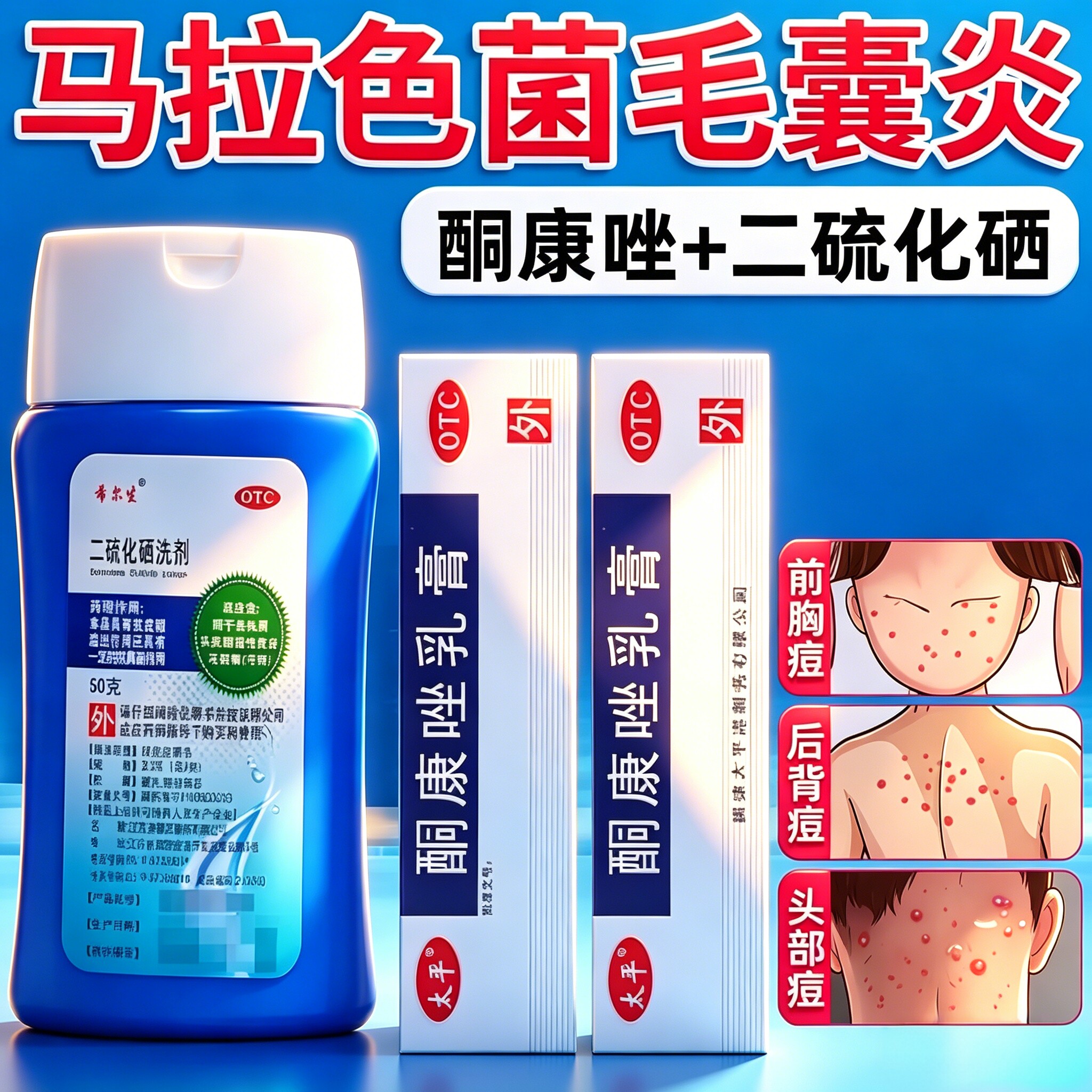 酮康唑乳膏搭二硫化硒洗剂正品真菌感染马拉色菌药毛囊炎药奈替酚