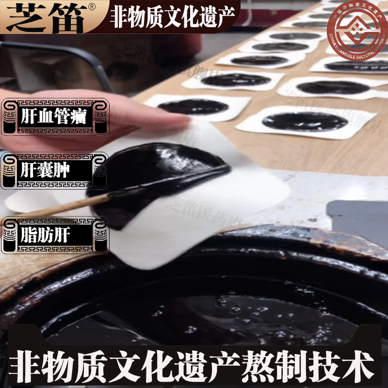 纯中药黑膏药针对肝囊肿血管瘤