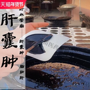 老医熬制肝囊肿治疗正品药贴胆息肉中药贴特肝血管瘤去除效多发性