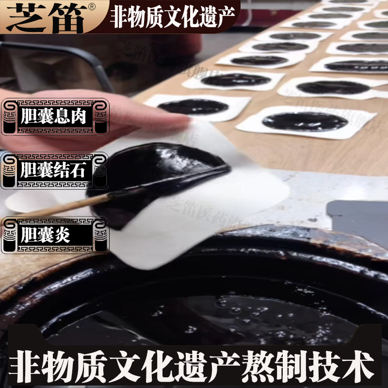 胆囊息肉效多发性特胆结石溶石化石排石专用胆囊息肉中膏贴调理