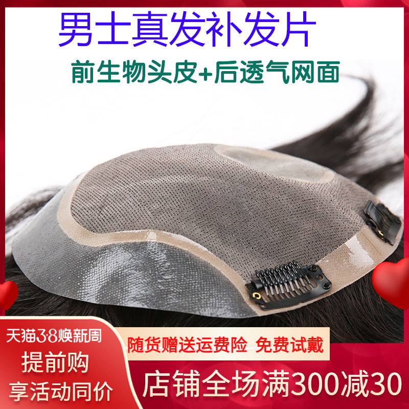 假发男头顶补发男真发短发帅气织发补发片男士秃顶前额发际线隐形
