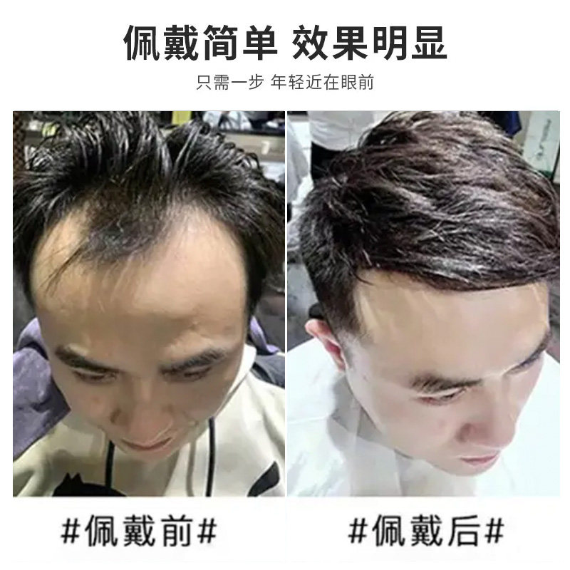 男士假发短发帅气全真发头顶自然逼真补发片递针旋生物头皮假发片