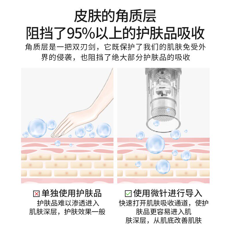 索利普 电动微针导入仪器水光自打mts导入中胚层头皮生发头微晶笔
