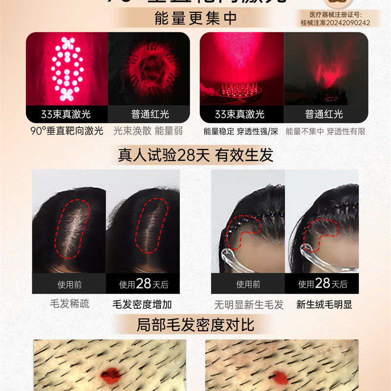 艾诗摩尔红光生发梳33束激光密发仪育发生发仪健发梳头发护理仪器