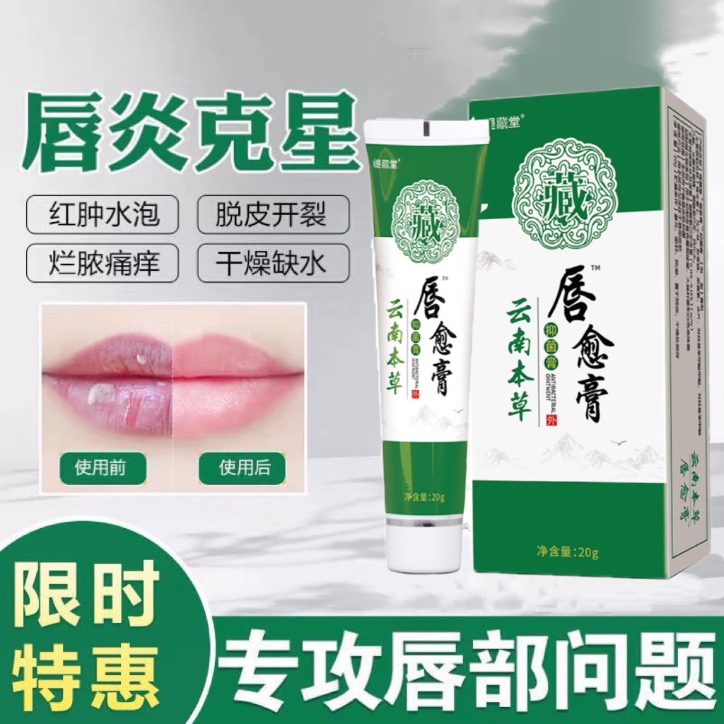 云南本草唇炎润膏专用嘴干