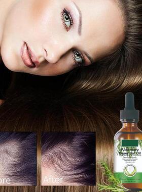 极速Rose Mary Oil Hair Growth Organic Essential TOil For Hai