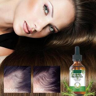 极速Rose Mary Oil Hair Growth Organic Essential TOil For Hai