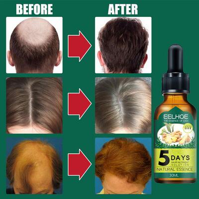极速5 Days Ginger Essential Ryegrowth Oil Nourish Scalp Repa