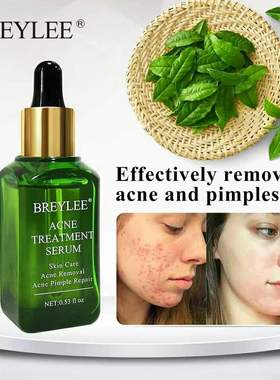 极速new Serum Face Essence Whitening RepaLir Pimple Acne Sca