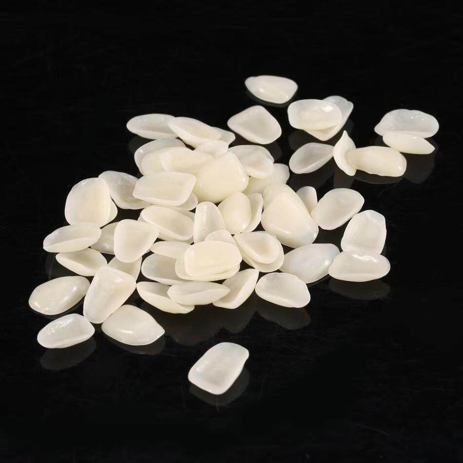 临时牙贴片牙贴面牙片牙齿发黑牙片烤瓷牙脱落超薄