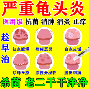 龟头炎症专用药膏克霉唑乳膏男性包皮炎效特私处瘙痒真菌感染止痒