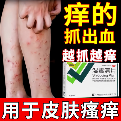 湿疹皮肤瘙痒越挠越痒血热型湿疹皮肤红斑腿部疙瘩清热凉血湿毒清