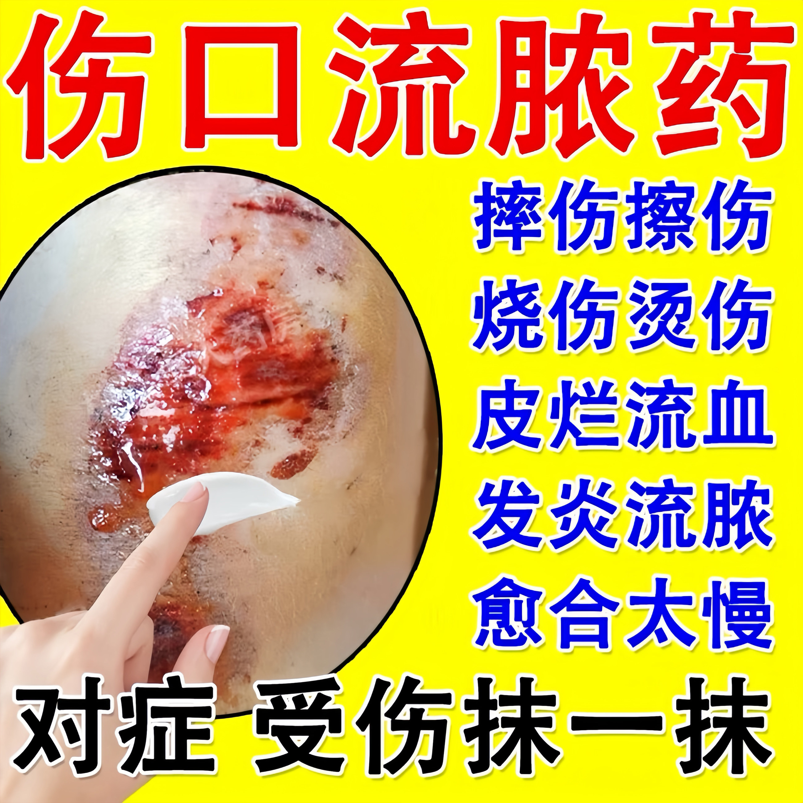红霉素软膏 治伤口流脓感染溃疡面感染摔伤外伤烫伤擦伤消炎膏
