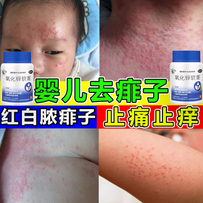 【双燕牌】氧化锌软膏15%*20g/瓶